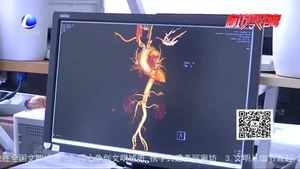 中石油醫(yī)院歷時6小時成功搶救一位復(fù)合外傷心臟破裂患者